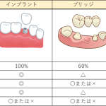インプラント、入れ歯、ブリッジどれが１番いい治療方法なの？「噛む力」から解説します！