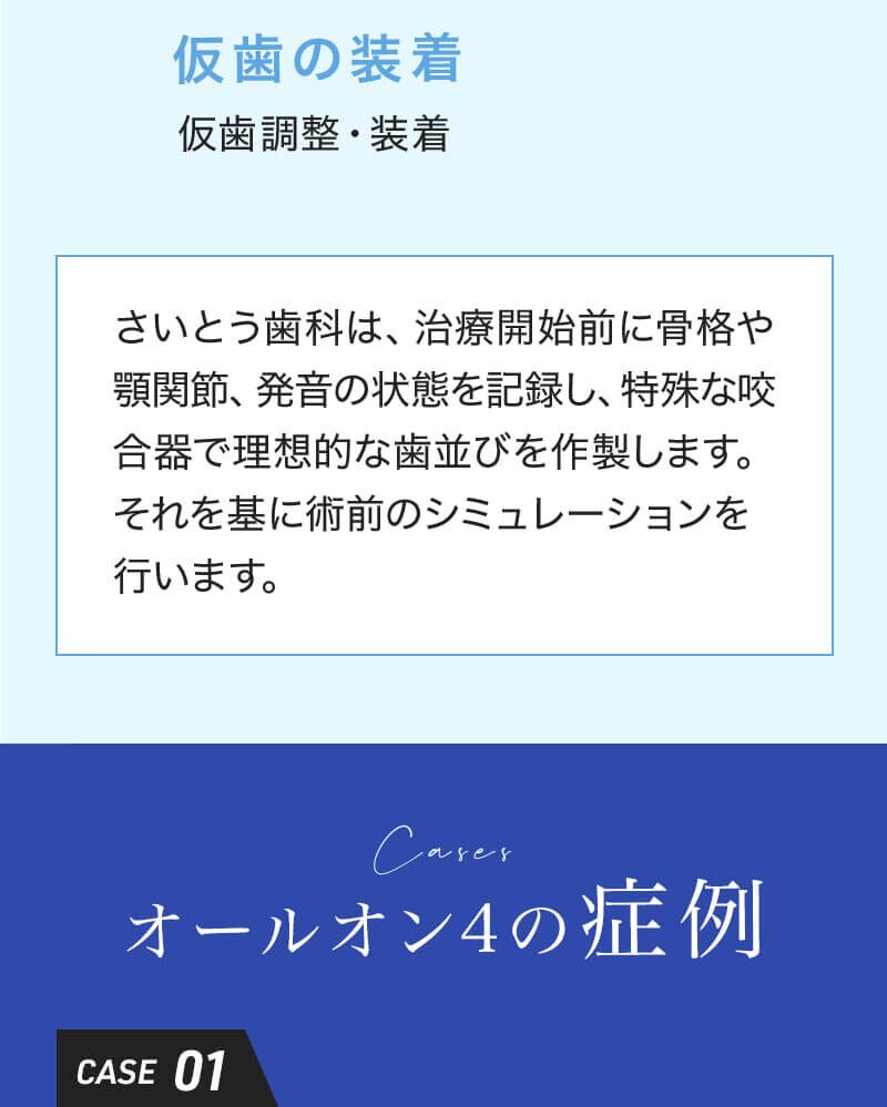 All-on-4（オール・オン・フォー）